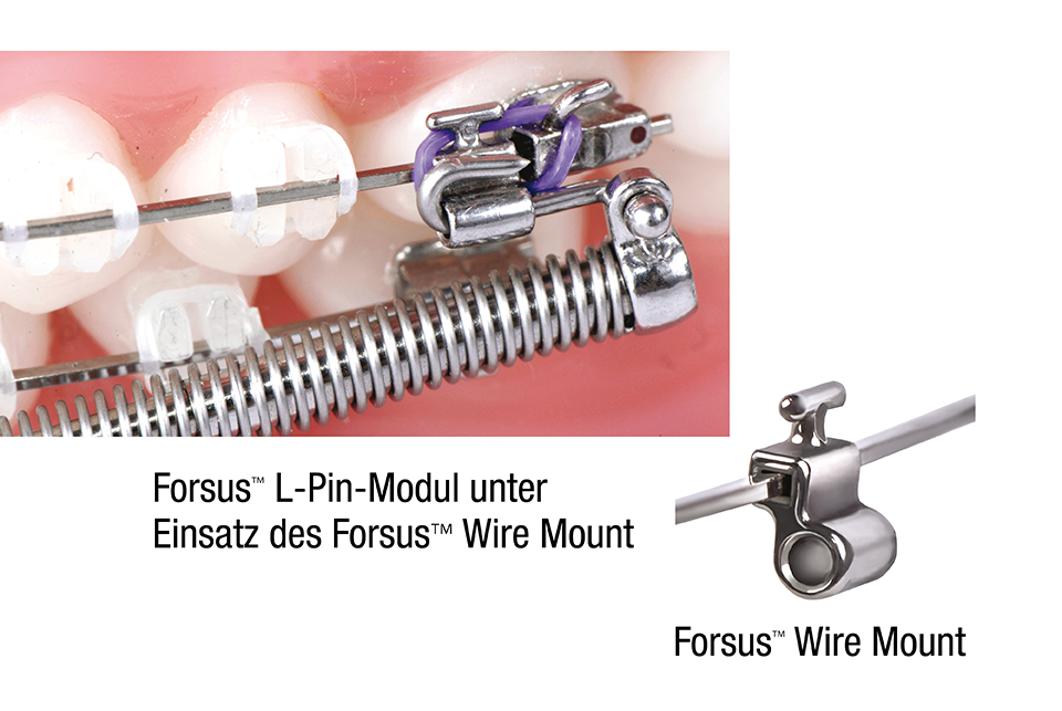 FORSUS WIRE MOUNT