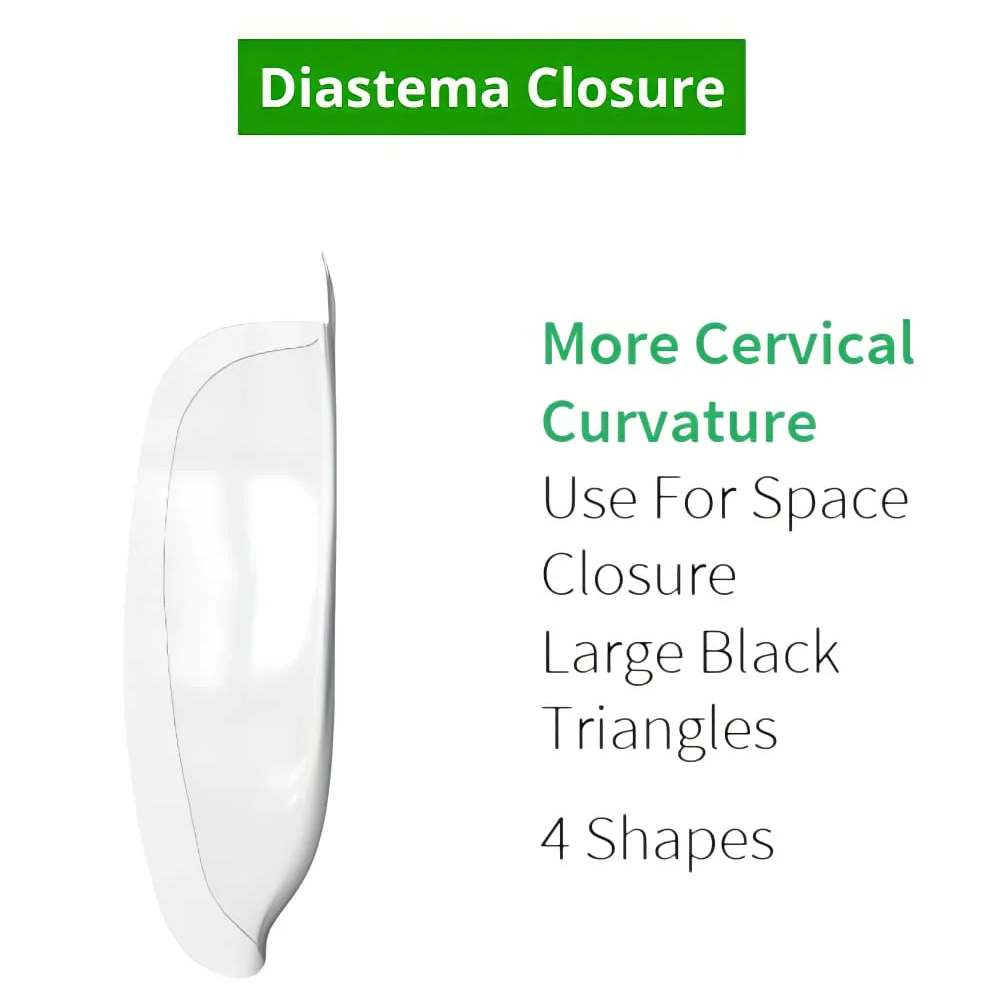 DIASTEMA CLOSURE UPPER MESIAL -DC 50CT