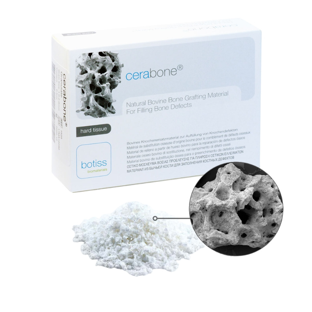 CERABONE G 1.0-2.0MM(LARGE) 1 GRAM