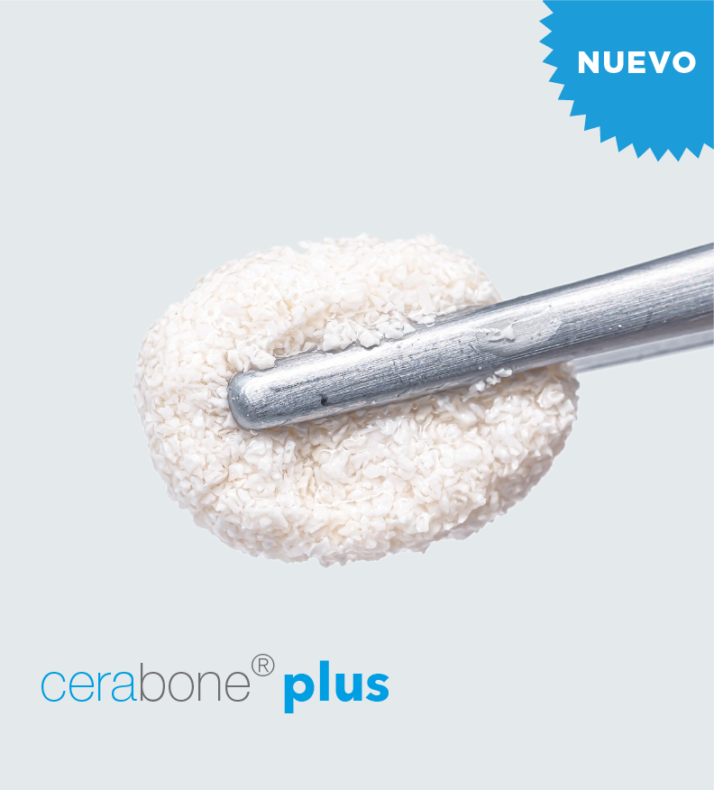 CERABONE PLUS 0.5-1.0 MM 1X1.0ML